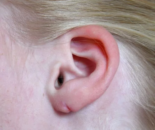Claires Ear Piercing Dangerous