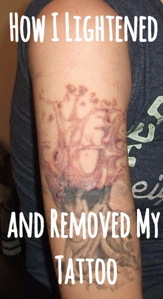 Remove Tattoo At Home Fast