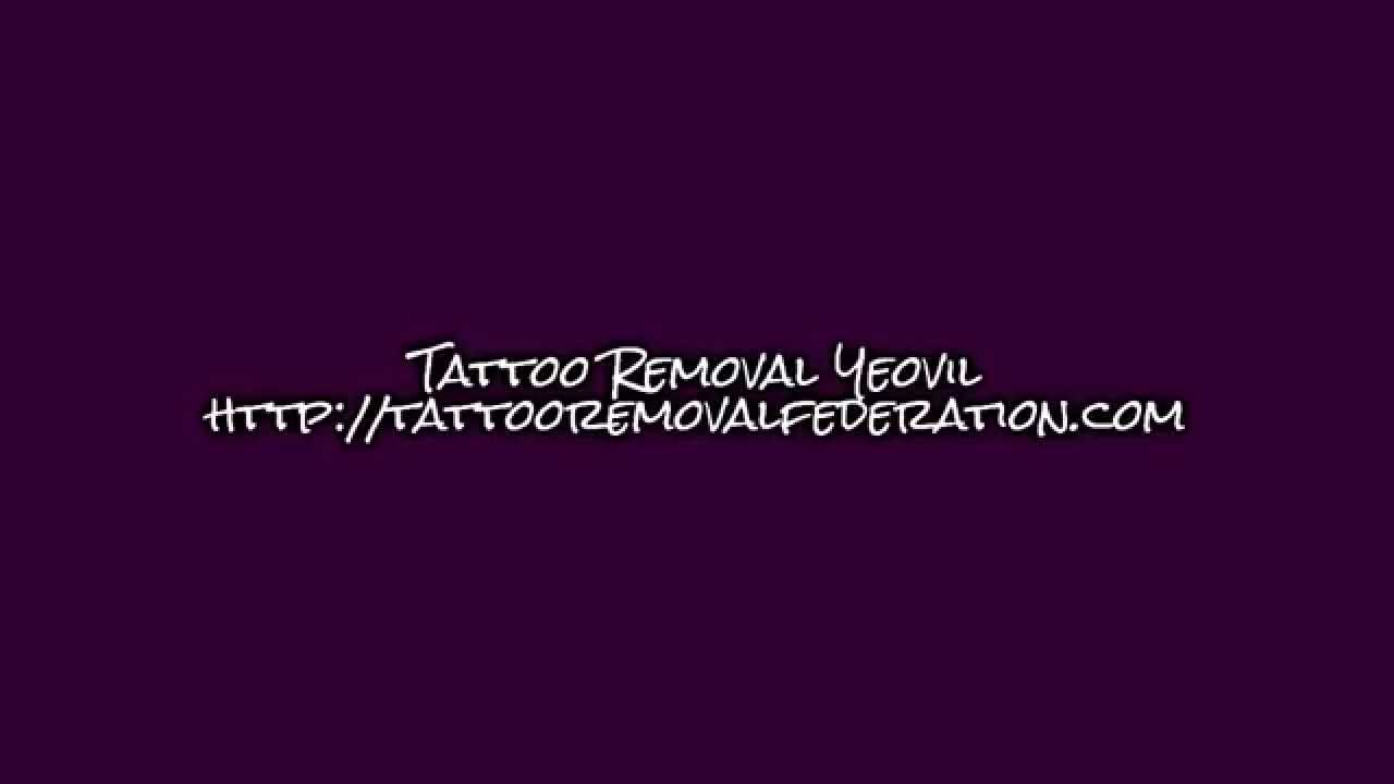 Tattoo Removal Yeovil